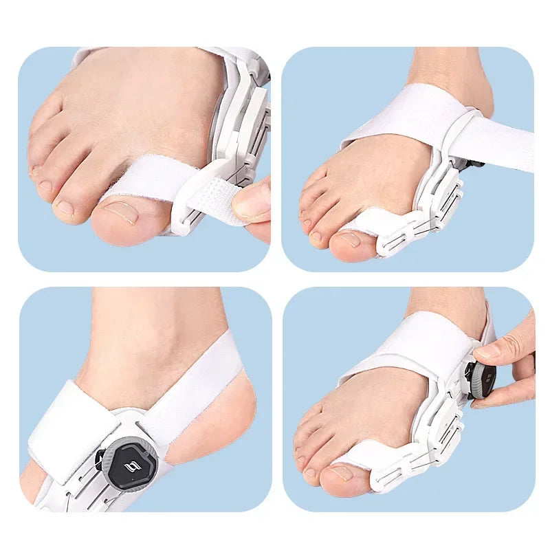 SoleMate™ Bunion Fix